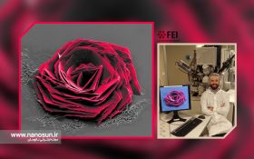 گـُل رُز سیستئین؛ برنده رقابت تصویربرداری میکروسکوپ الکترونی